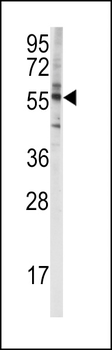 CYP4F8 Antibody (C-term)