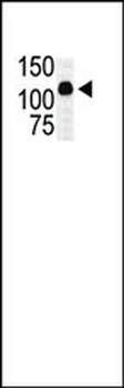 MLK2 Antibody (C-term)