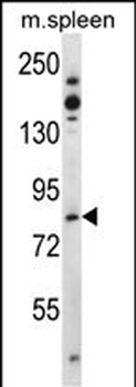 Tiparp Antibody (N-term)