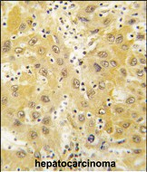 Tiparp Antibody (N-term)