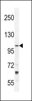 TLL2 Antibody (N-term)