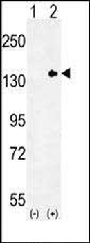 TLL2 Antibody (N-term)