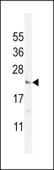 UTS2 Antibody (N-term)