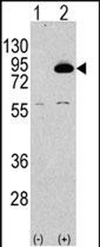 PIK3R2 Antibody (N-term)