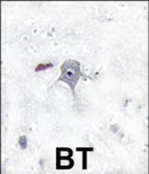 PIK3R2 Antibody (N-term)