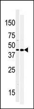 MOS Antibody (N-term)