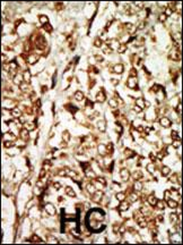MOS Antibody (N-term)