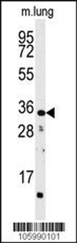 CTDSP2 Antibody (N-term)