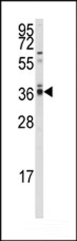 PP2A alpha Antibody (N-term)