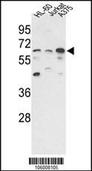 PPP3CC Antibody (N-term)