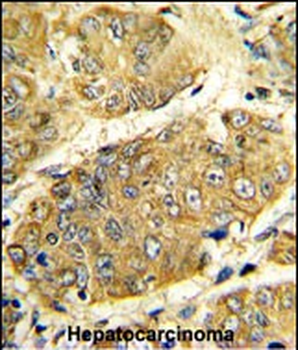 LTA Antibody (Center)