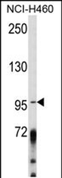 AKAP3 Antibody (Center)
