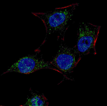 SCAP Antibody (Center)