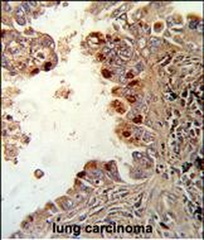 PRKCA Antibody (N-term)