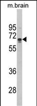 ZMYND11 Antibody (N-term)