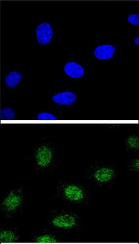 ESRRA Antibody (Center)