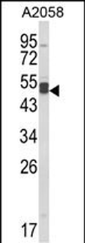 AGPAT3 Antibody (Center)