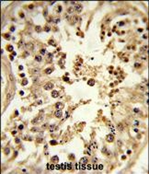 CDC42EP3 Antibody (N-term)