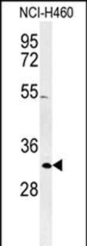 XPA Antibody (C-term)