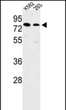 SLC3A1 Antibody (Center)