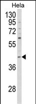 NCK1 Antibody (N-term)