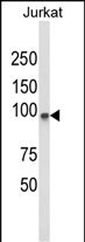 PLCL1 Antibody (N-term)
