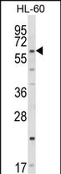 CYP51A1 Antibody (C-term)