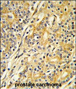 CYP51A1 Antibody (C-term)