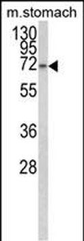 TCERG1L Antibody (Center)