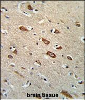 TCERG1L Antibody (Center)