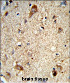 DAB1 Antibody (Center)