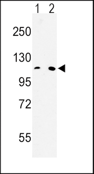 MTTP Antibody (C-term)