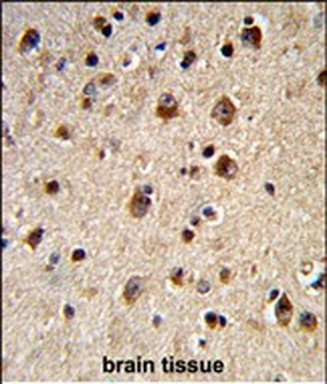 ADRBK2 Antibody (N-term)