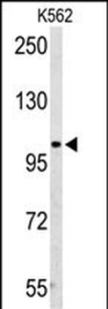 AMPD2 Antibody (Center)