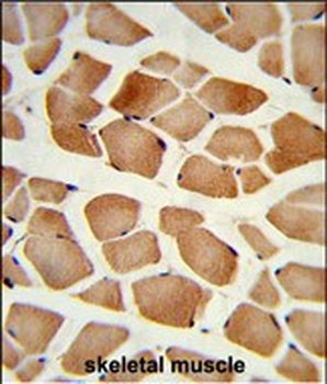 AMPD2 Antibody (Center)