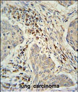 KXD1 Antibody (Center)