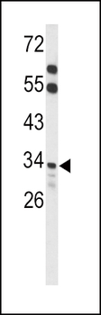 ACOT8 Antibody (C-term)