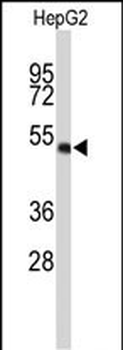 WDR37 Antibody (C-term)