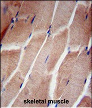 RPL5 Antibody (N-term)