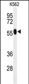 ACSM1 Antibody (N-term)