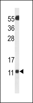SH3BGRL3 Antibody (Center)