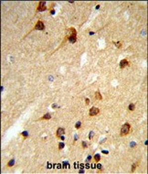 CENPK Antibody (C-term)