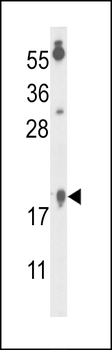 FA96B Antibody (N-term)