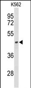 ND2 Antibody (N-term)