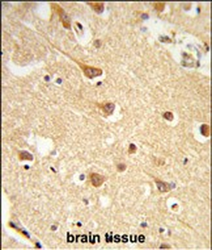 ND2 Antibody (N-term)