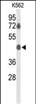 BTBD10 Antibody (Center)