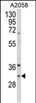 ING5 Antibody (Center)