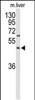 GPR160 Antibody (C-term)