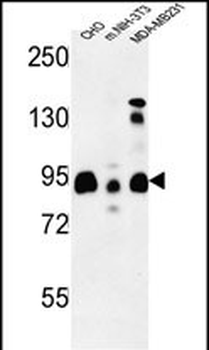 SGIP1 Antibody (N-term)