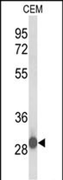 KATNBL1 Antibody (N-term)